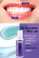 LECTUNE Diş Beyazlatıcı Mor Jel | Anında Beyazlatma Etkili Diş Jeli | 75 ml
